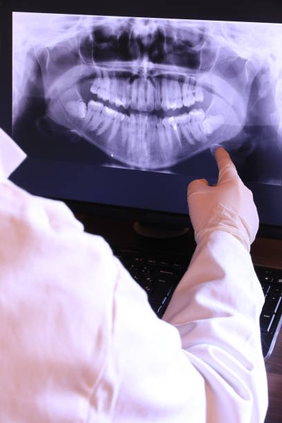 Best Emergency Dental Care for Broken or Chipped Teeth in Monongahela, PA
